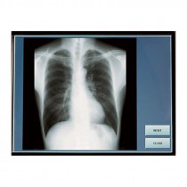 • Radiographie en vision directe sur l’écran du radio mobile
• X-ray in direct vision on the mobile radio screen
